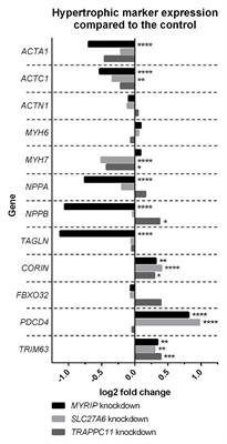 Whole-Exome Sequencing and hiPSC Cardiomyocyte Models Identify MYRIP, TRAPPC11, and SLC27A6 of Potential Importance to Left Ventricular Hypertrophy in an African Ancestry Population